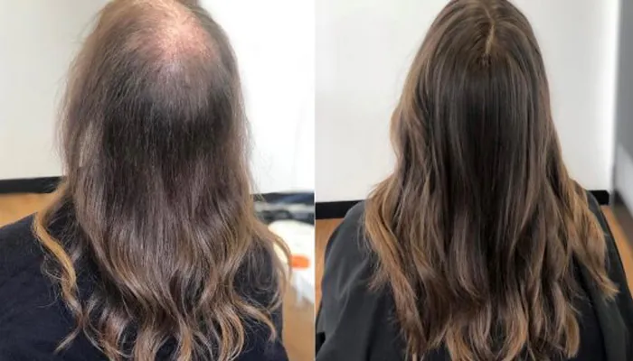 Antes e depois tratamento capilar